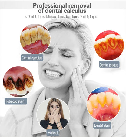Ultrasonic Tooth Cleaner