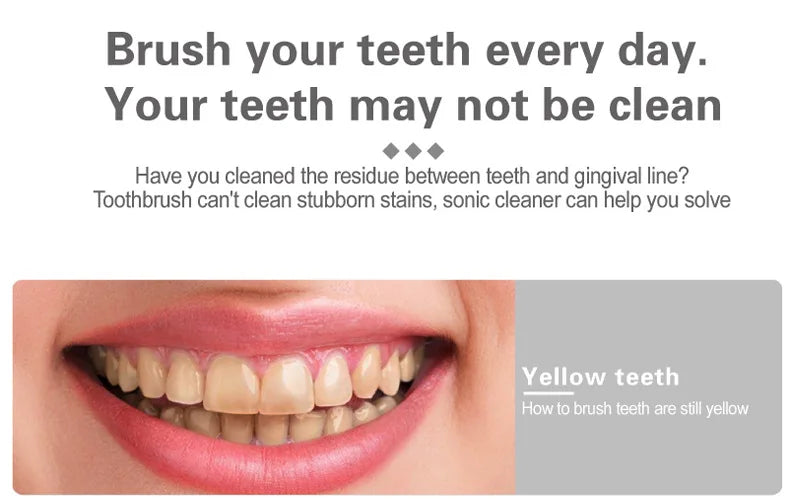 Ultrasonic Tooth Cleaner
