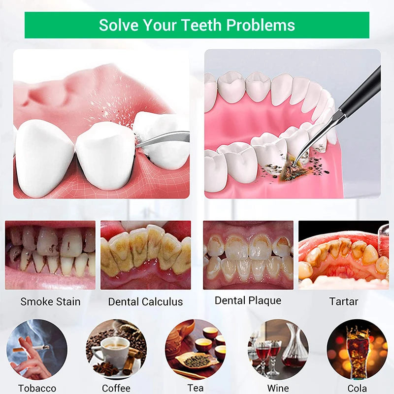 Ultrasonic Tooth Cleaner