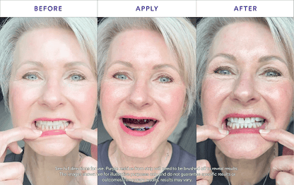 New V34 Whitening Strips